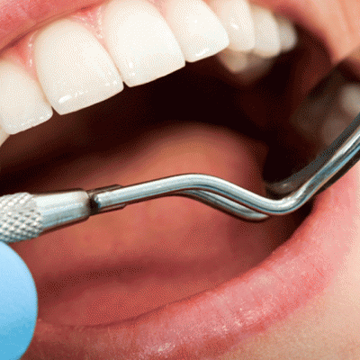Скидка 3% на лечение зубов